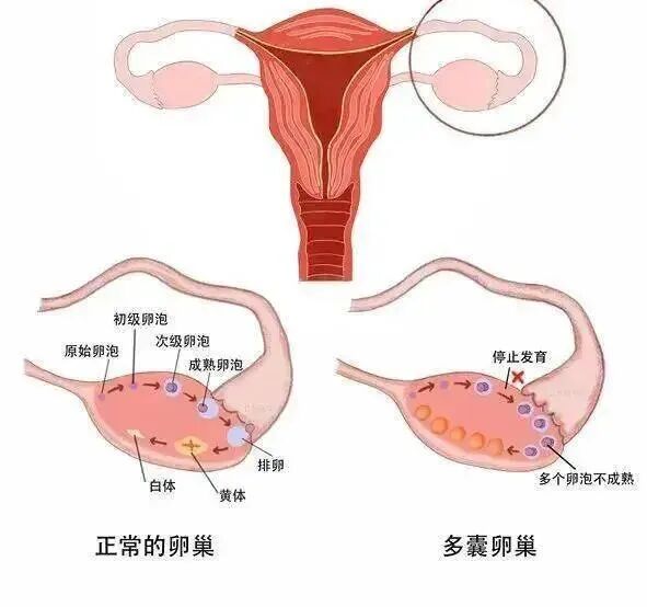 2026男女性激素六项自查？正常值参考表！一看便懂