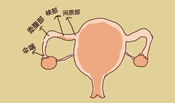 输卵管堵塞怎么办？堵塞后如何备孕?