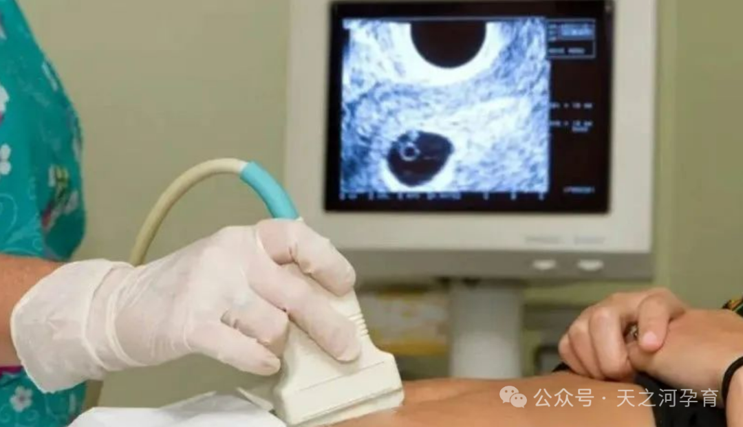 自然周期囊胚怎么移植？