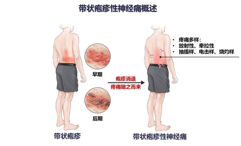 a6ee6112ddb2db920ccb9713ee59d9ac.png