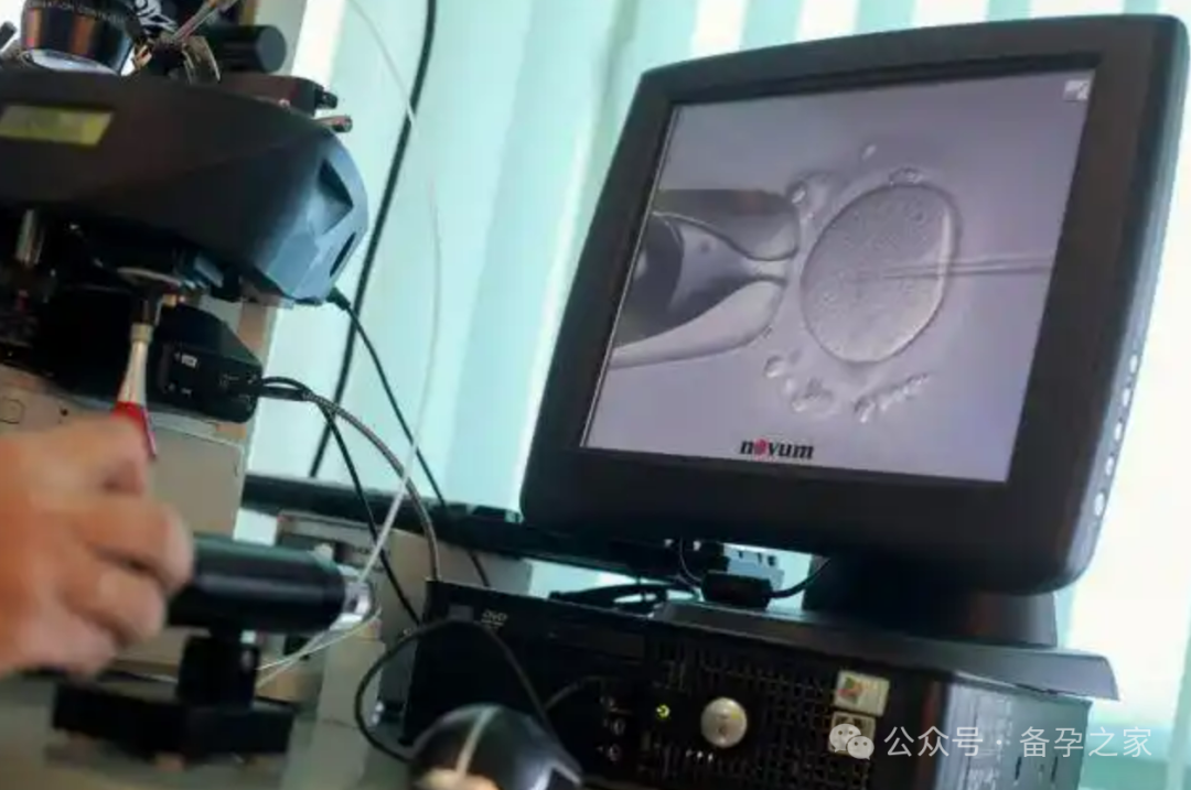 你们都是移植几次才成功的？