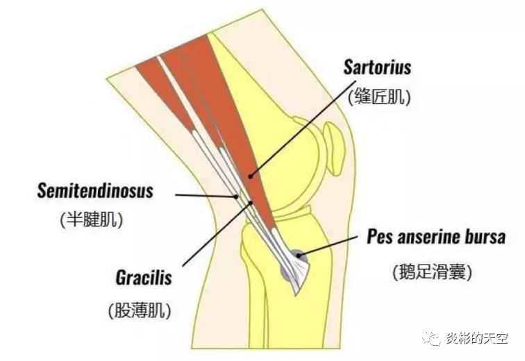足肌腱疼痛对于用股薄肌和缝匠肌肌腱做acl重建的叉友来说,术后的康复