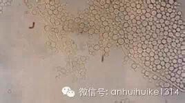 妇可馨凝胶怎么用创新型植物妇科凝胶用药产品 --妇可馨医用抗菌凝胶，面向全国招商_https://www.jmylbn.com_新闻资讯_第8张