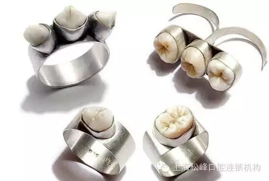 【口腔新闻】牙齿的艺术鉴赏