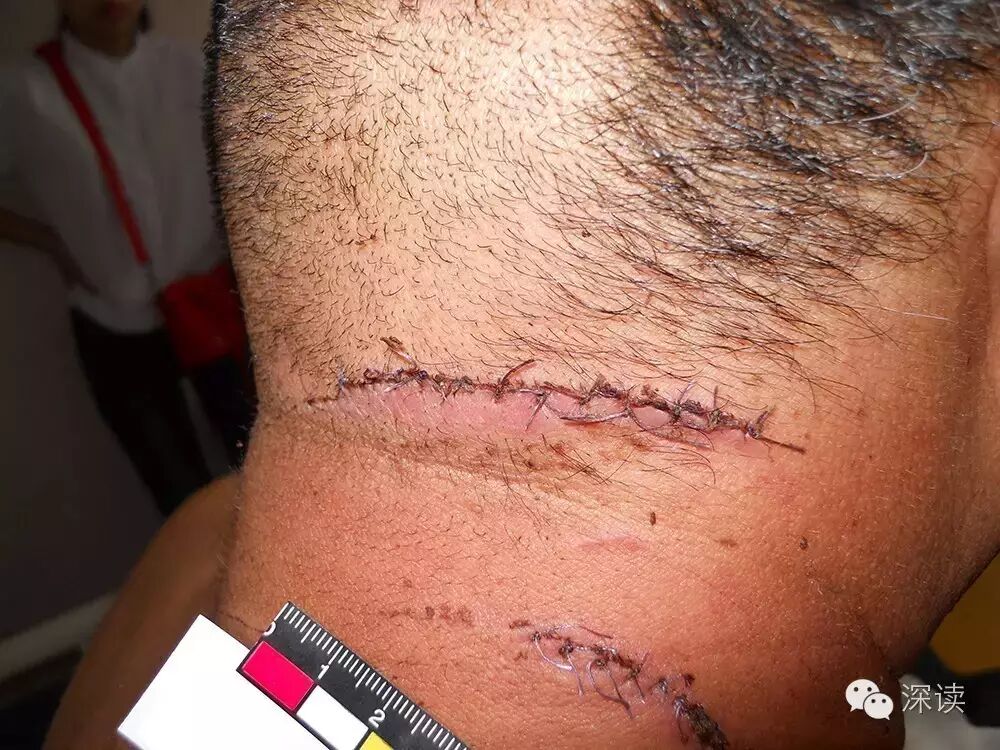 河北唐山区人大代表疑女友出轨将媒人砍成重伤图1