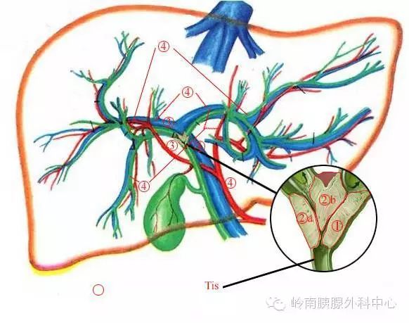 胆囊供血动脉解剖图片图片