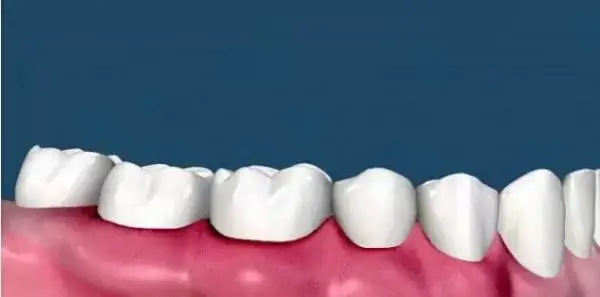 Dentistry Nunawading | Dental Clinic Melbourne