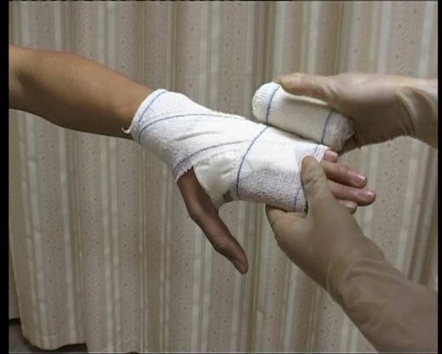 8字法2包扎方法:每一圈,先使绷带螺旋向上,到肢体渐粗的位置时把绷带