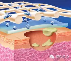 人工敷料怎么照顾伤口临床常见伤口敷料的优点和缺点_https://www.jmylbn.com_新闻资讯_第17张