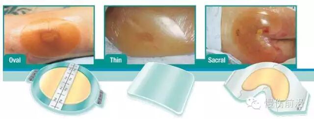 人工敷料怎么照顾伤口临床常见伤口敷料的优点和缺点_https://www.jmylbn.com_新闻资讯_第11张