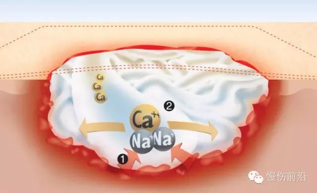 人工敷料怎么照顾伤口临床常见伤口敷料的优点和缺点_https://www.jmylbn.com_新闻资讯_第13张