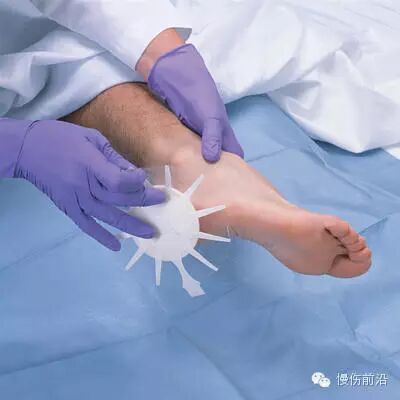 人工敷料怎么照顾伤口临床常见伤口敷料的优点和缺点_https://www.jmylbn.com_新闻资讯_第9张