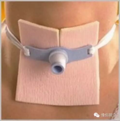 人工敷料怎么照顾伤口临床常见伤口敷料的优点和缺点_https://www.jmylbn.com_新闻资讯_第8张