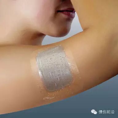 人工敷料怎么照顾伤口临床常见伤口敷料的优点和缺点_https://www.jmylbn.com_新闻资讯_第14张