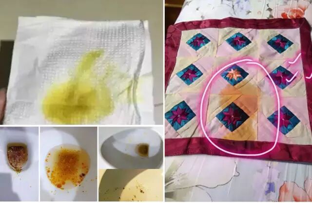 的油脂和脂肪,被赛乐赛阻断了,无法被肠道吸收,原封不动被排出体外!