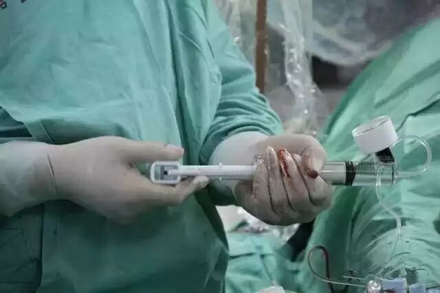 【干货】支架介入手术图文直播