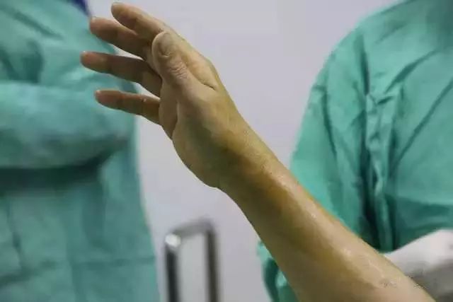 【干货】支架介入手术图文直播