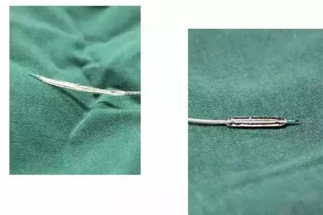 【干货】支架介入手术图文直播