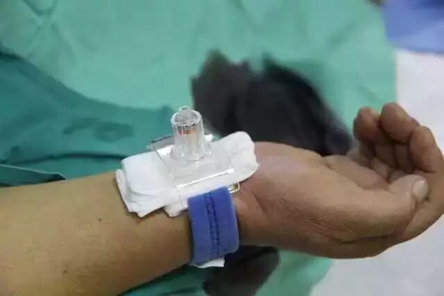 【干货】支架介入手术图文直播