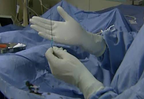 【干货】支架介入手术图文直播