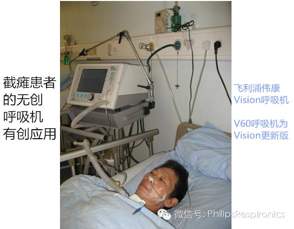 epap什么模式无创呼吸机（二）_https://www.jmylbn.com_新闻资讯_第30张