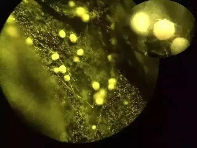 安化黑茶 | 认识金花（冠突散囊菌）的功能好处