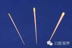 口腔H锉怎么消毒根管治疗的细节把握（细节决定成败）_https://www.jmylbn.com_新闻资讯_第8张