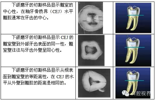 口腔H锉怎么消毒根管治疗的细节把握（细节决定成败）_https://www.jmylbn.com_新闻资讯_第32张