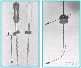 口腔H锉怎么消毒根管治疗的细节把握（细节决定成败）_https://www.jmylbn.com_新闻资讯_第20张