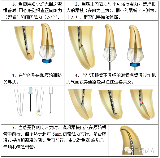 口腔H锉怎么消毒根管治疗的细节把握（细节决定成败）_https://www.jmylbn.com_新闻资讯_第35张