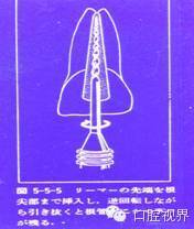口腔H锉怎么消毒根管治疗的细节把握（细节决定成败）_https://www.jmylbn.com_新闻资讯_第12张