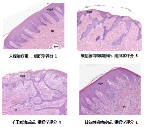 牙科喷砂枪怎么用洁牙只用超声？你out了！_https://www.jmylbn.com_新闻资讯_第7张
