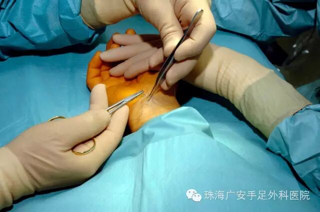 手足外伤小伤口的急救误区