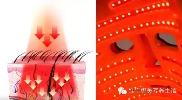 无创仪器是什么高科技美容时代——原装意大利进口贝嘉文系列仪器！_https://www.jmylbn.com_新闻资讯_第14张