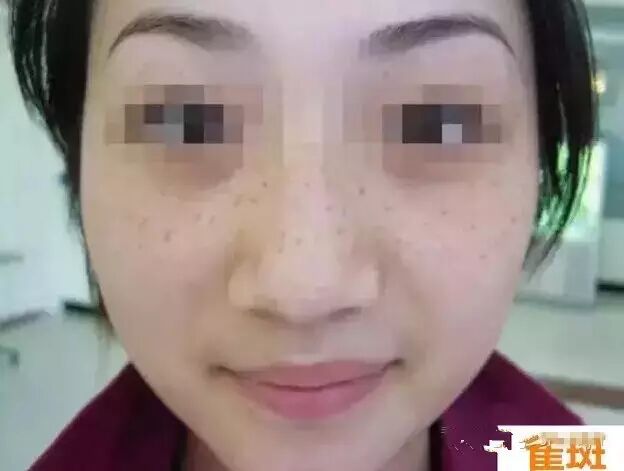 安惠夕阳红配合面膜，让你暗斑全无，年轻25岁！