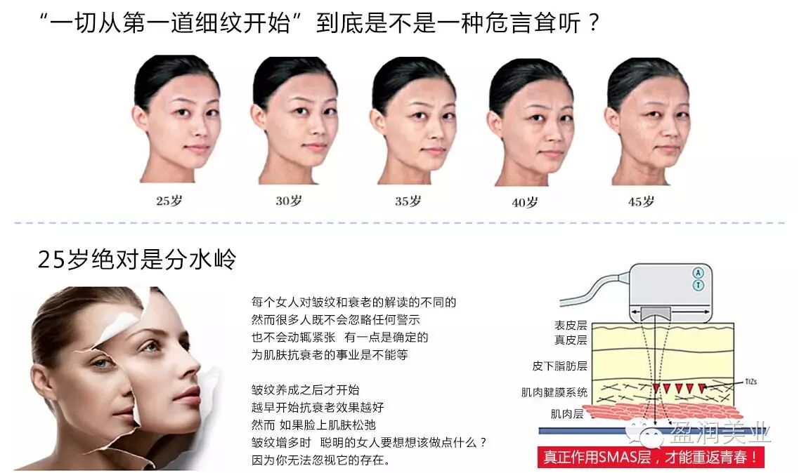 皮下筋膜层胶原蛋白的流逝会造成肌肉,脂肪下垂.