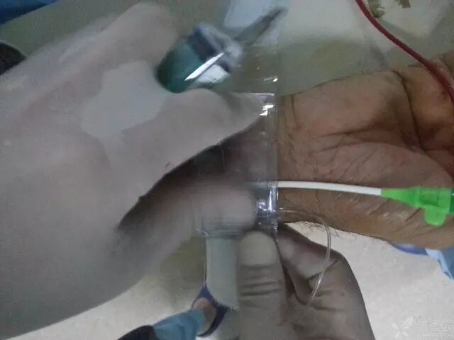 造影导丝是什么原来心脏造影这样做：冠脉造影全程图解_https://www.jmylbn.com_新闻资讯_第18张