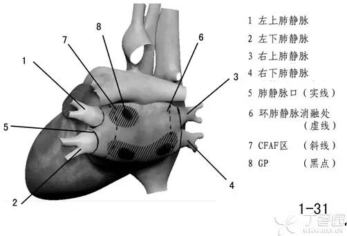 左心室流出道解剖图片