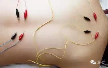 理疗贴片怎么用【周太医】大、小贴片的原理及使用_https://www.jmylbn.com_新闻资讯_第3张