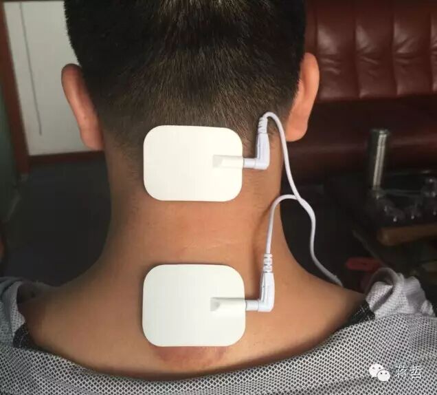 理疗贴片怎么用【周太医】大、小贴片的原理及使用_https://www.jmylbn.com_新闻资讯_第5张