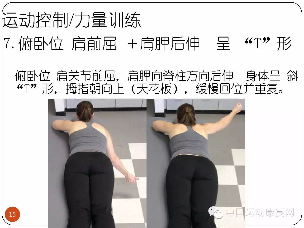 肩痛肩峰撞击综合征的运动康复治疗方案