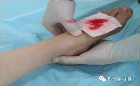 动脉什么压迫止血指压止血法_https://www.jmylbn.com_新闻资讯_第11张