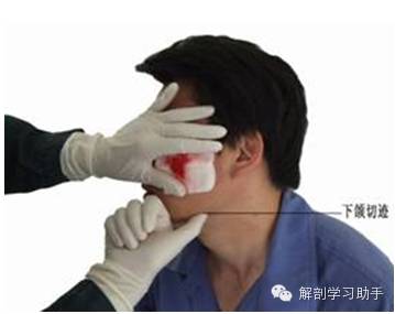 动脉什么压迫止血指压止血法_https://www.jmylbn.com_新闻资讯_第3张