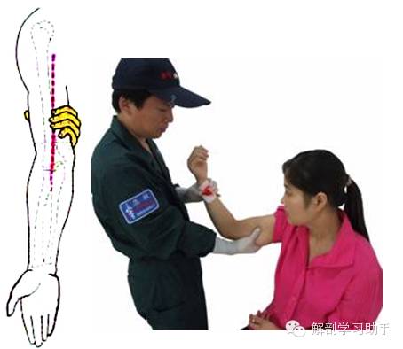 动脉什么压迫止血指压止血法_https://www.jmylbn.com_新闻资讯_第6张