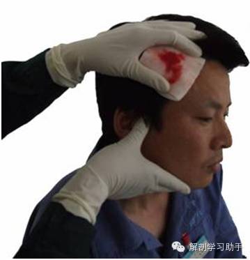 动脉什么压迫止血指压止血法_https://www.jmylbn.com_新闻资讯_第4张