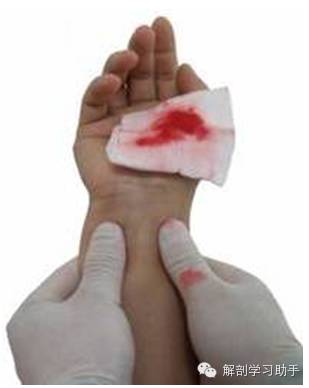 动脉什么压迫止血指压止血法_https://www.jmylbn.com_新闻资讯_第7张
