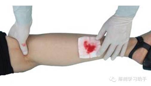 动脉什么压迫止血指压止血法_https://www.jmylbn.com_新闻资讯_第10张
