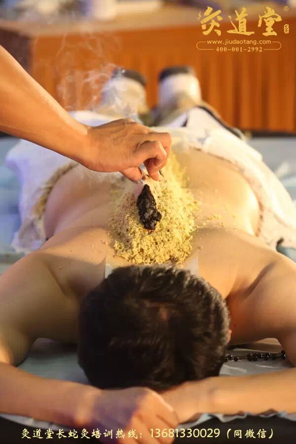 长蛇灸产品加盟班:改良版药物铺灸特种灸法班,每月26日开课!