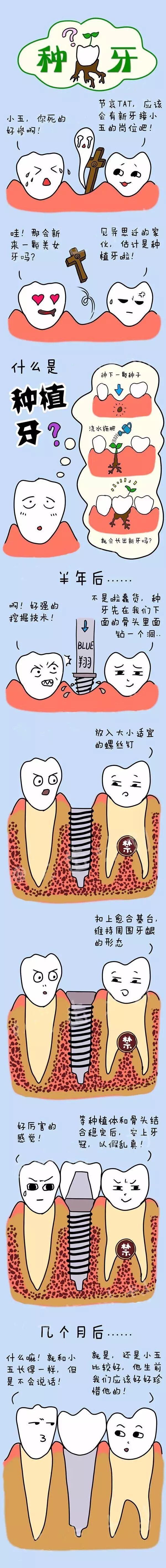 漫画解析——什么是种植牙？