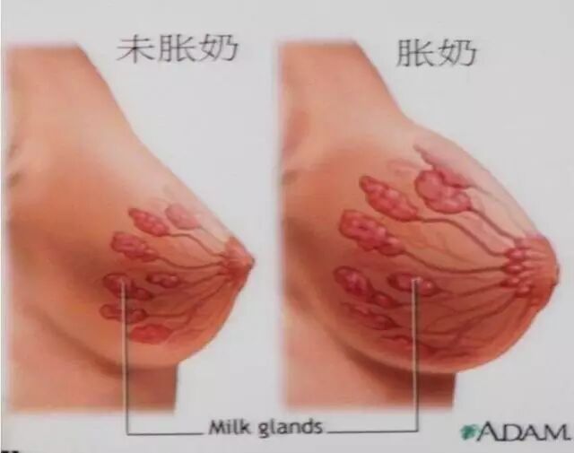 带你认识生理性乳涨，拒绝暴力催乳！
